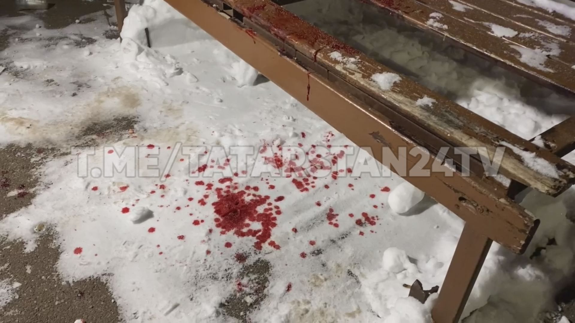 Ночью в Казани прохожие обнаружили истекающего кровью мужчину