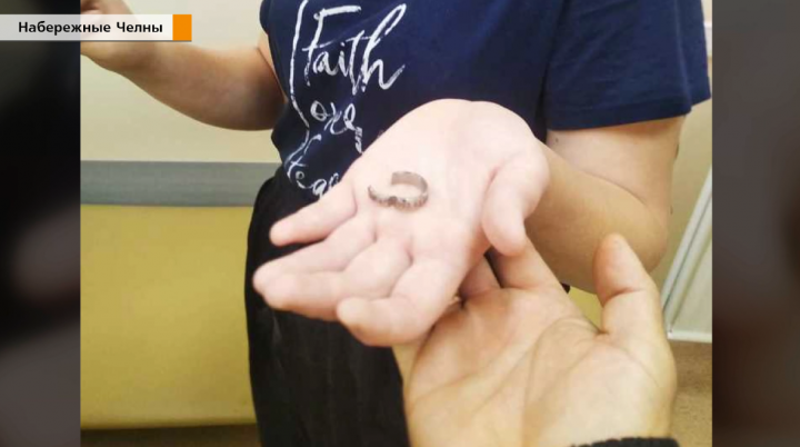 В Татарстане спасатели помогли девочке, которая не могла снять с пальца кольцо