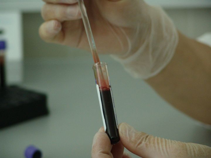 На этой неделе в Казани горожане смогут бесплатно сдать тест на ВИЧ
