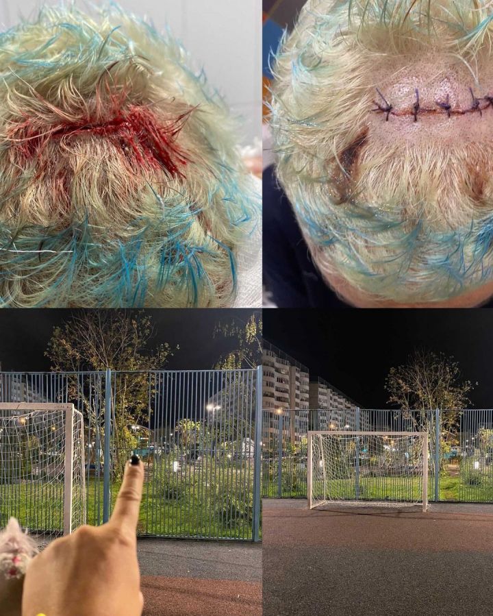 В Казани женщина разбила себе голову об забор, играя с сыном в футбол