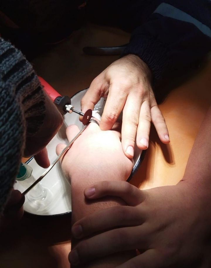 В Лениногорске на пальце школьника застряла часть подшипника - потребовалась помощь спасателей
