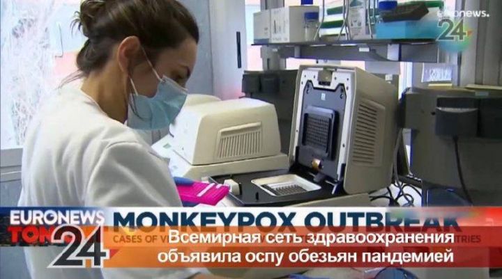 Всемирная сеть здравоохранения объявила оспу обезьян пандемией