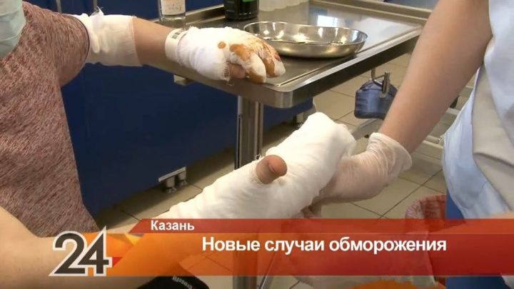 В Казани за день четыре человека получили обморожения из-за аномальных морозов
