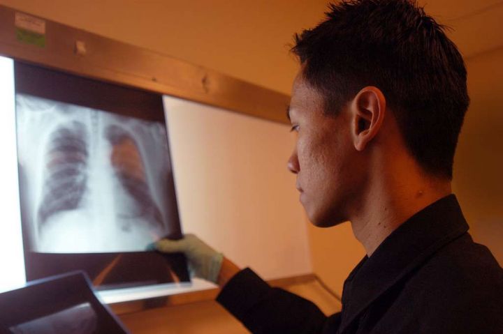 «Бороться нужно на уровне государства»: врач рассказала, как избежать пандемии туберкулеза