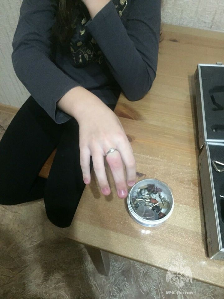 В Казани спасатели помогли девочке снять кольцо с опухшего пальца