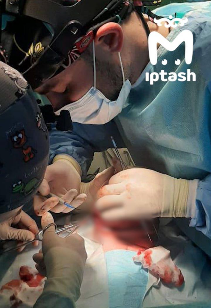 Казанские хирурги удалили килограммовую опухоль младенцу